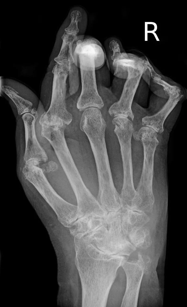 Bone & joint disease radiograph for self-assessment