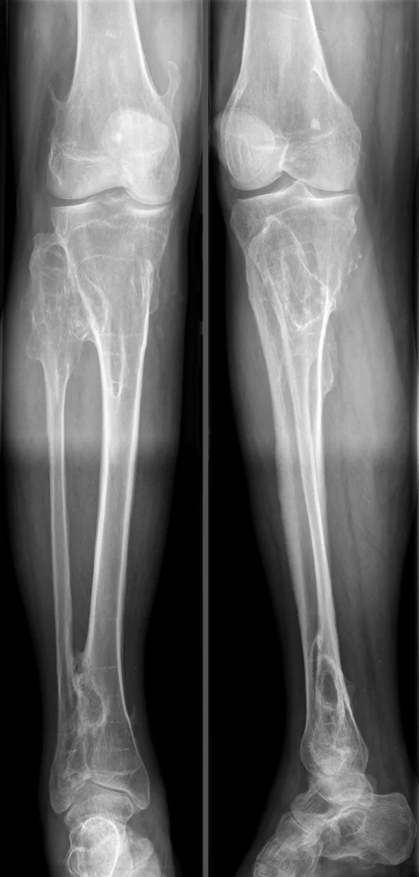 Bone & joint disease radiograph for self-assessment