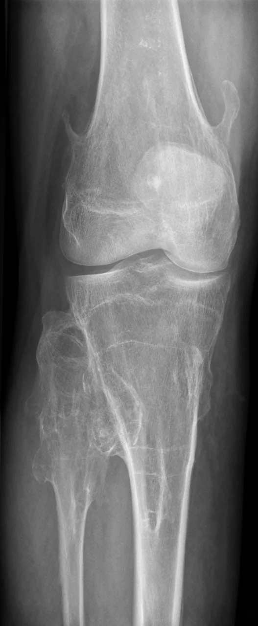 Bone & joint disease radiograph for self-assessment
