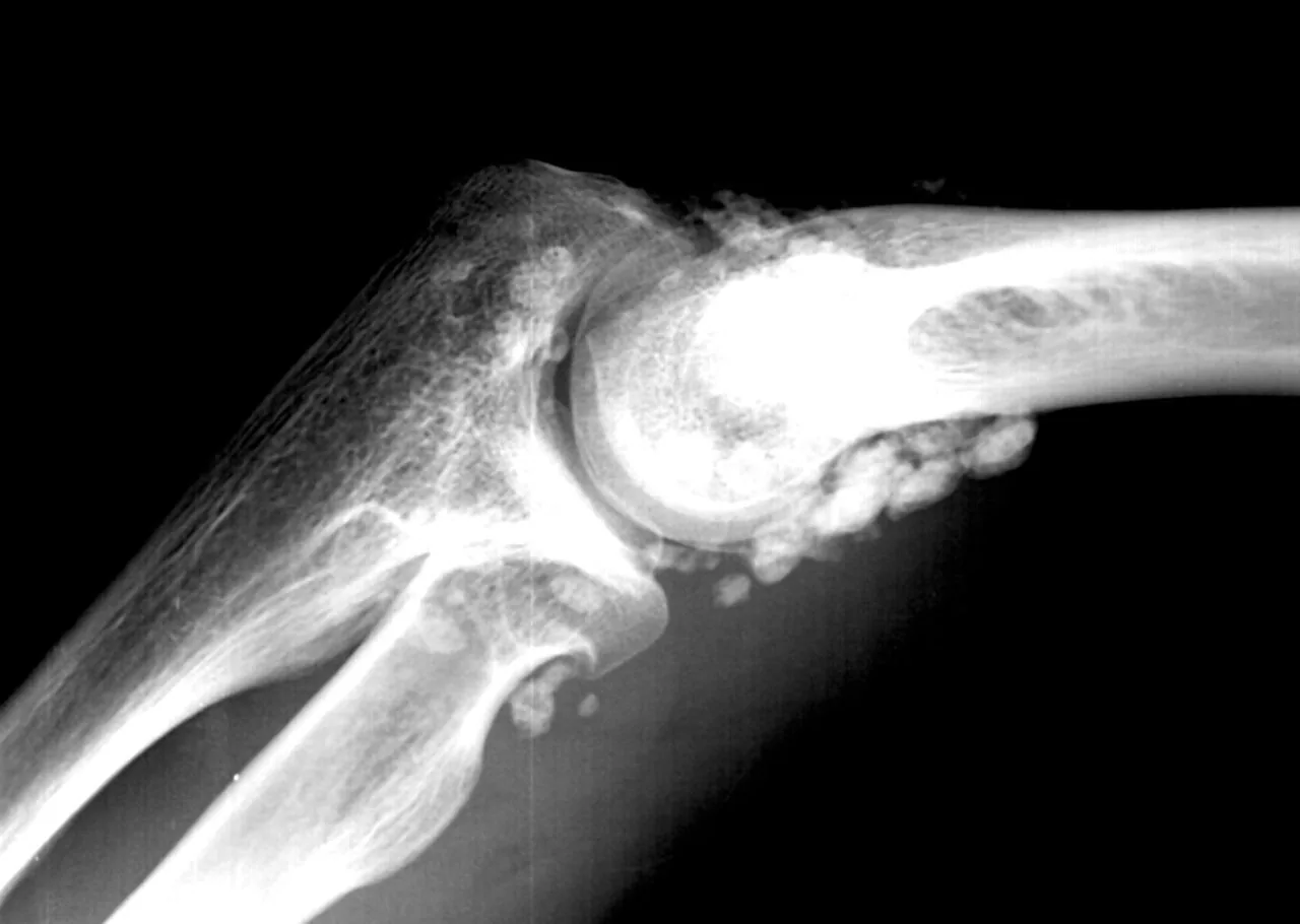 Bone & joint disease radiograph for self-assessment