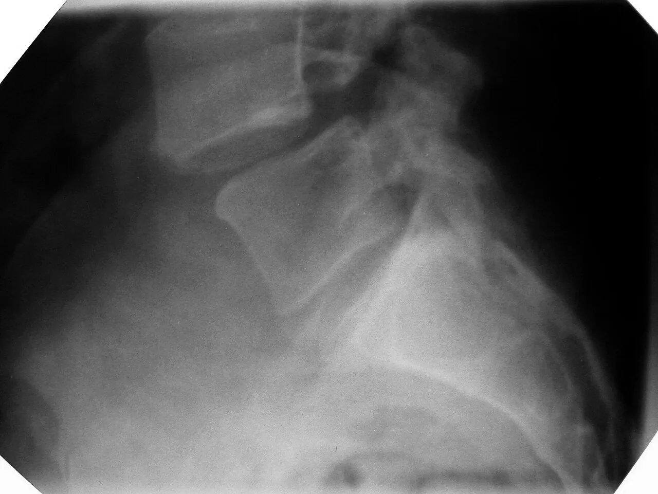 Spine radiograph for self-assessment