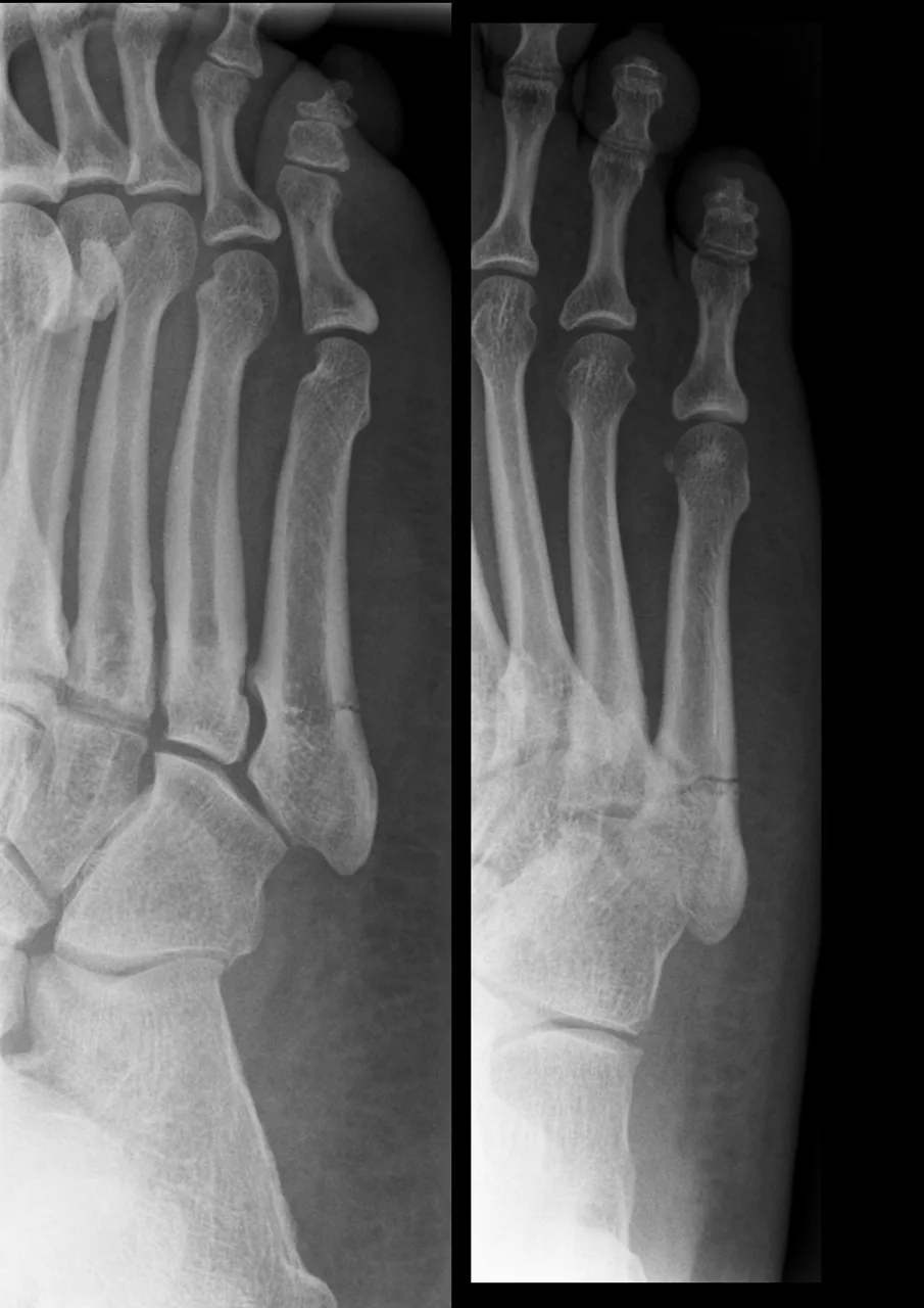 Lower limb radiograph for self-assessment