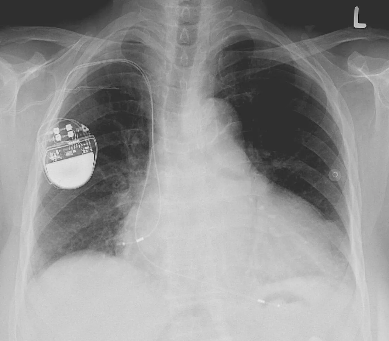 Lines & tubes radiograph for self-assessment