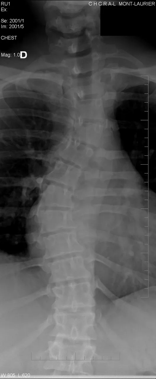 Spine radiograph for self-assessment