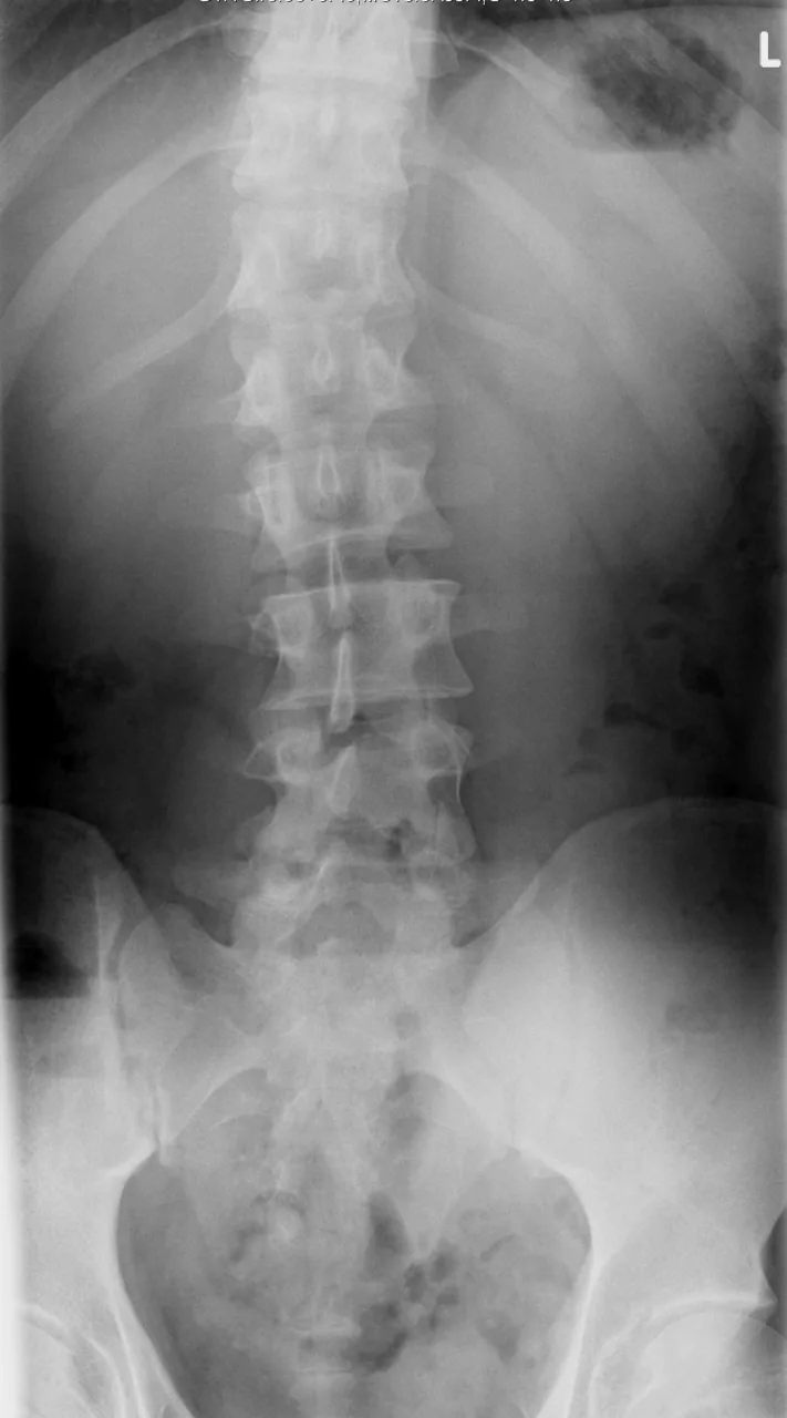 Spine radiograph for self-assessment