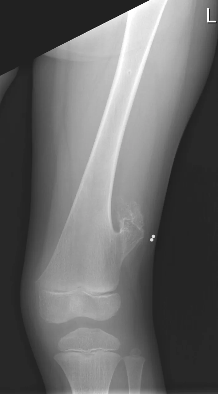 Bone & joint disease radiograph for self-assessment