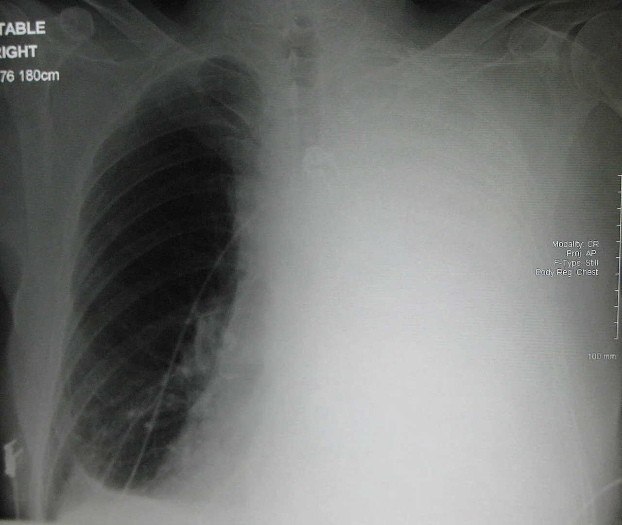 Chest radiograph for self-assessment