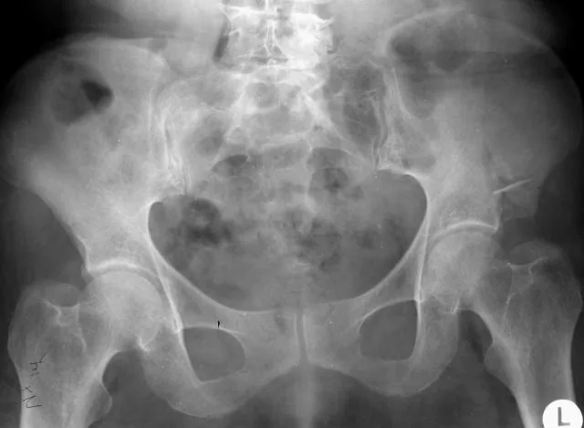 Lower limb radiograph for self-assessment
