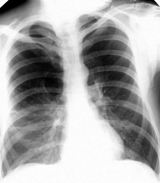 Chest radiograph for self-assessment