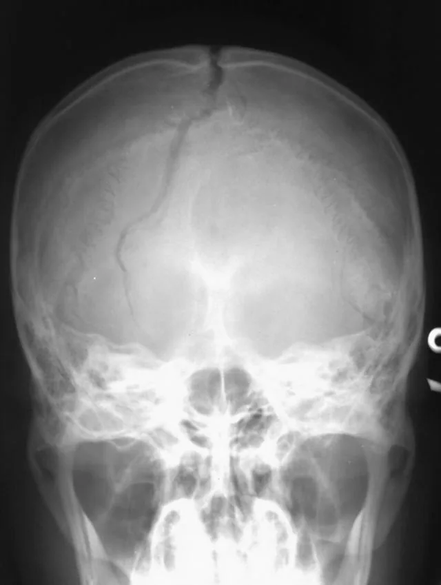 Skull & face radiograph for self-assessment