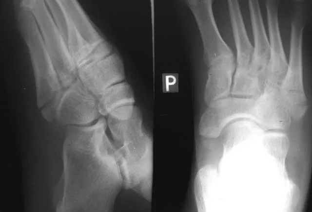 Lower limb radiograph for self-assessment