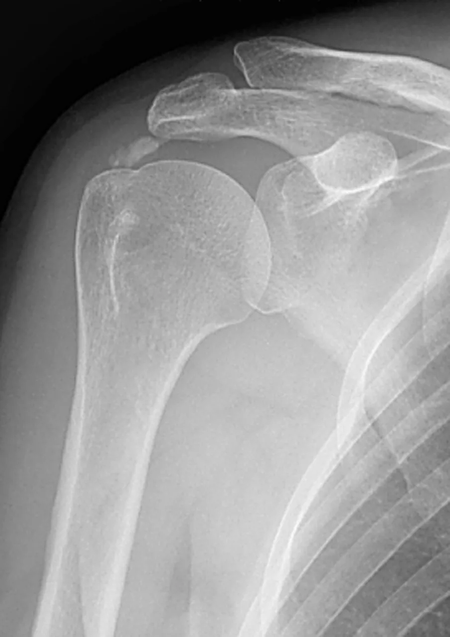 Upper limb radiograph for self-assessment