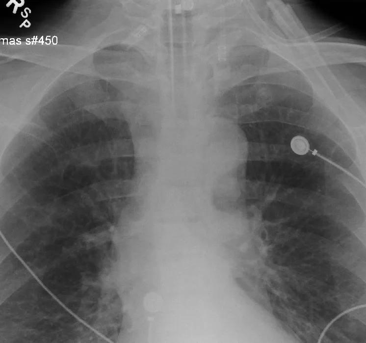 Lines & tubes radiograph for self-assessment