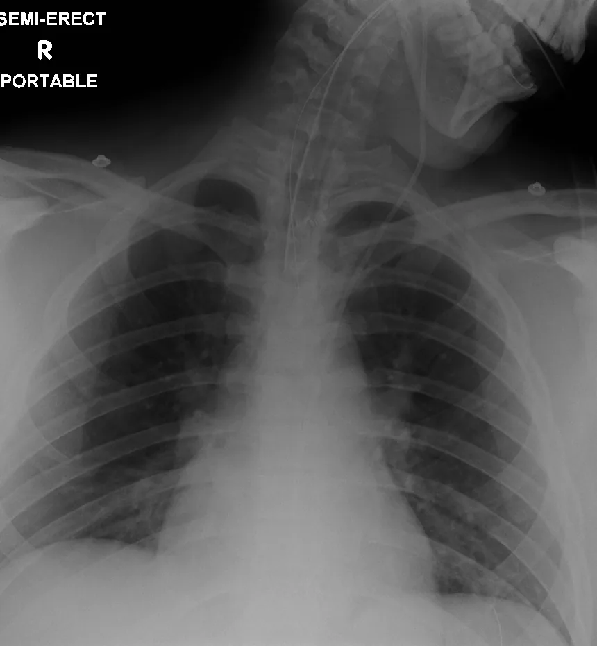 Lines & tubes radiograph for self-assessment