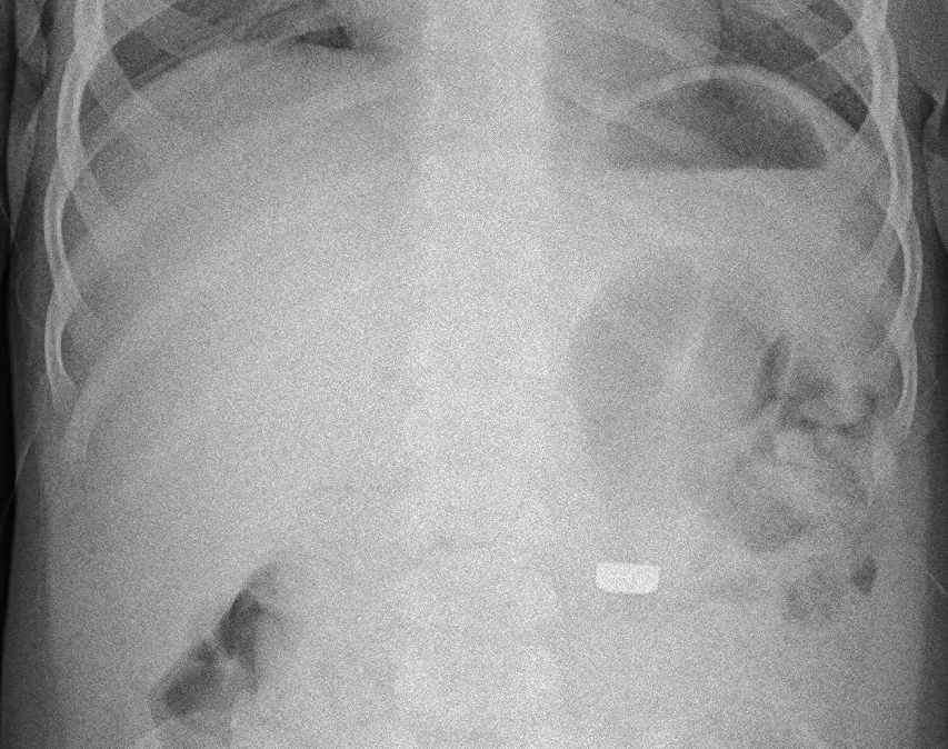 Abdomen radiograph for self-assessment