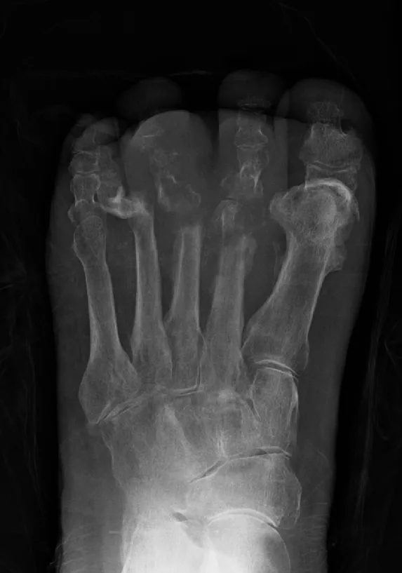 Bone & joint disease radiograph for self-assessment