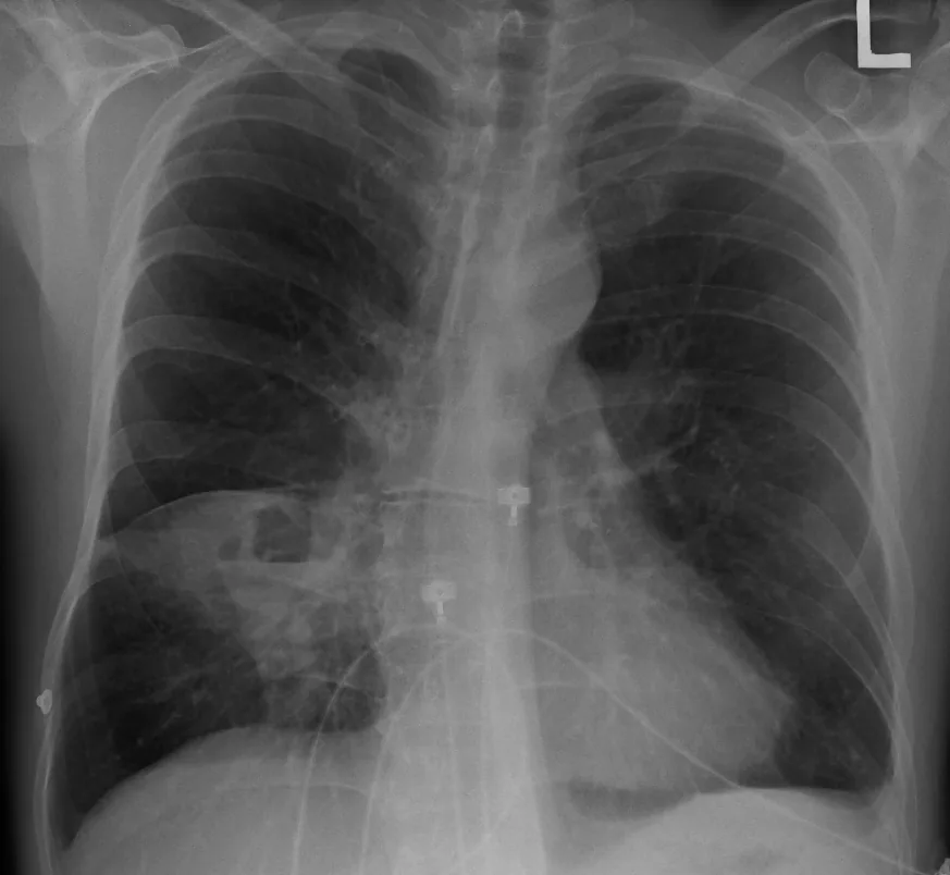 Chest radiograph for self-assessment
