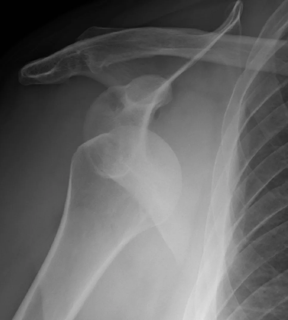 Upper limb radiograph for self-assessment