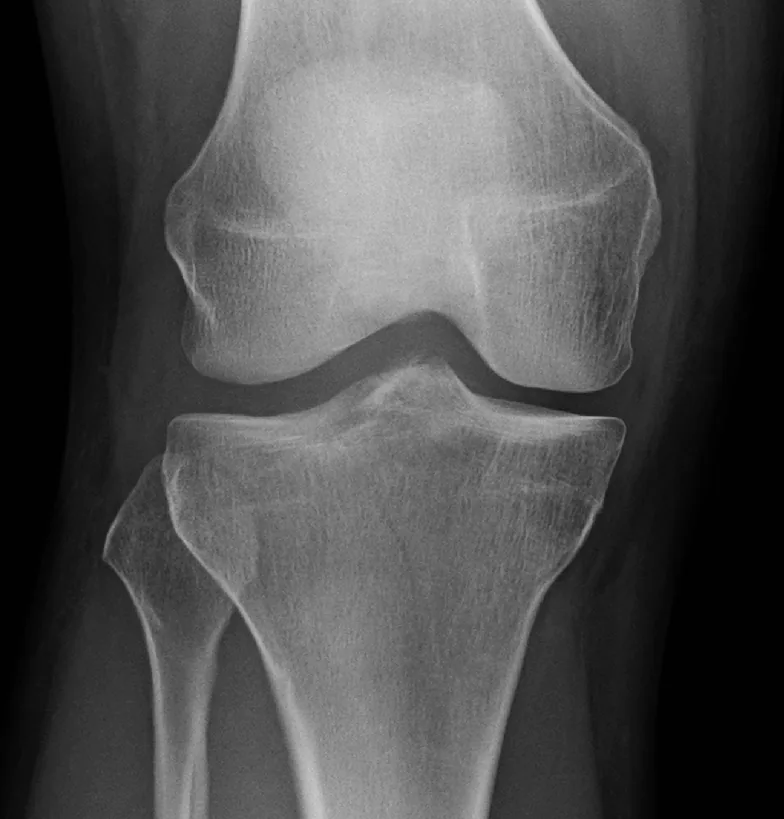Lower limb radiograph for self-assessment