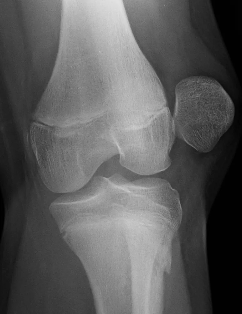 Lower limb radiograph for self-assessment