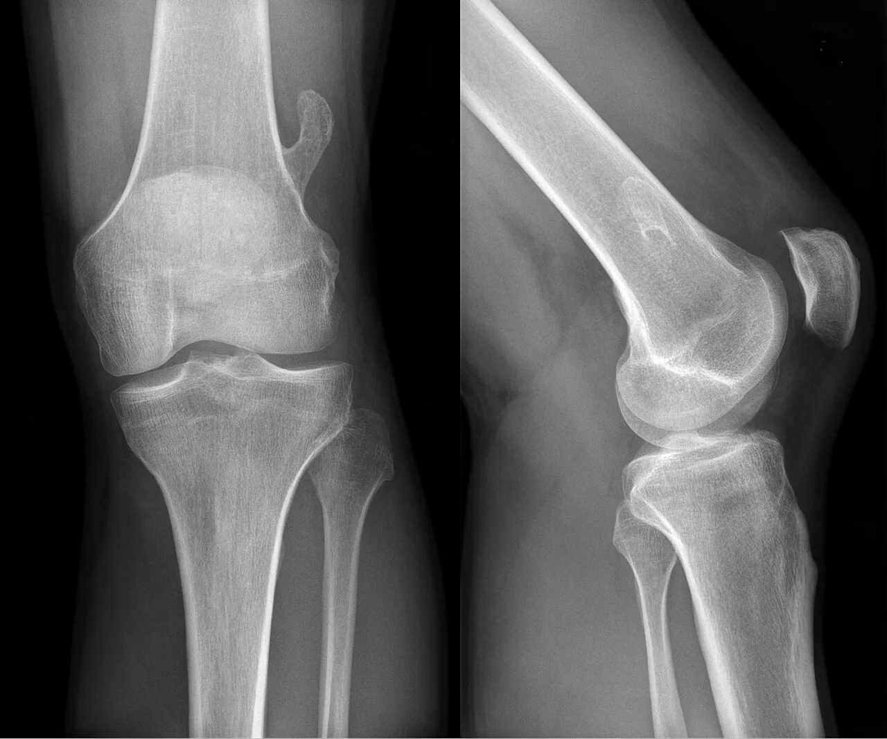 Bone & joint disease radiograph for self-assessment