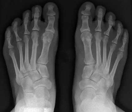 Bone & joint disease radiograph for self-assessment