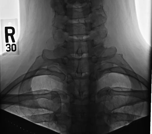 Chest radiograph for self-assessment