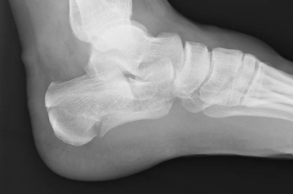 Lower limb radiograph for self-assessment