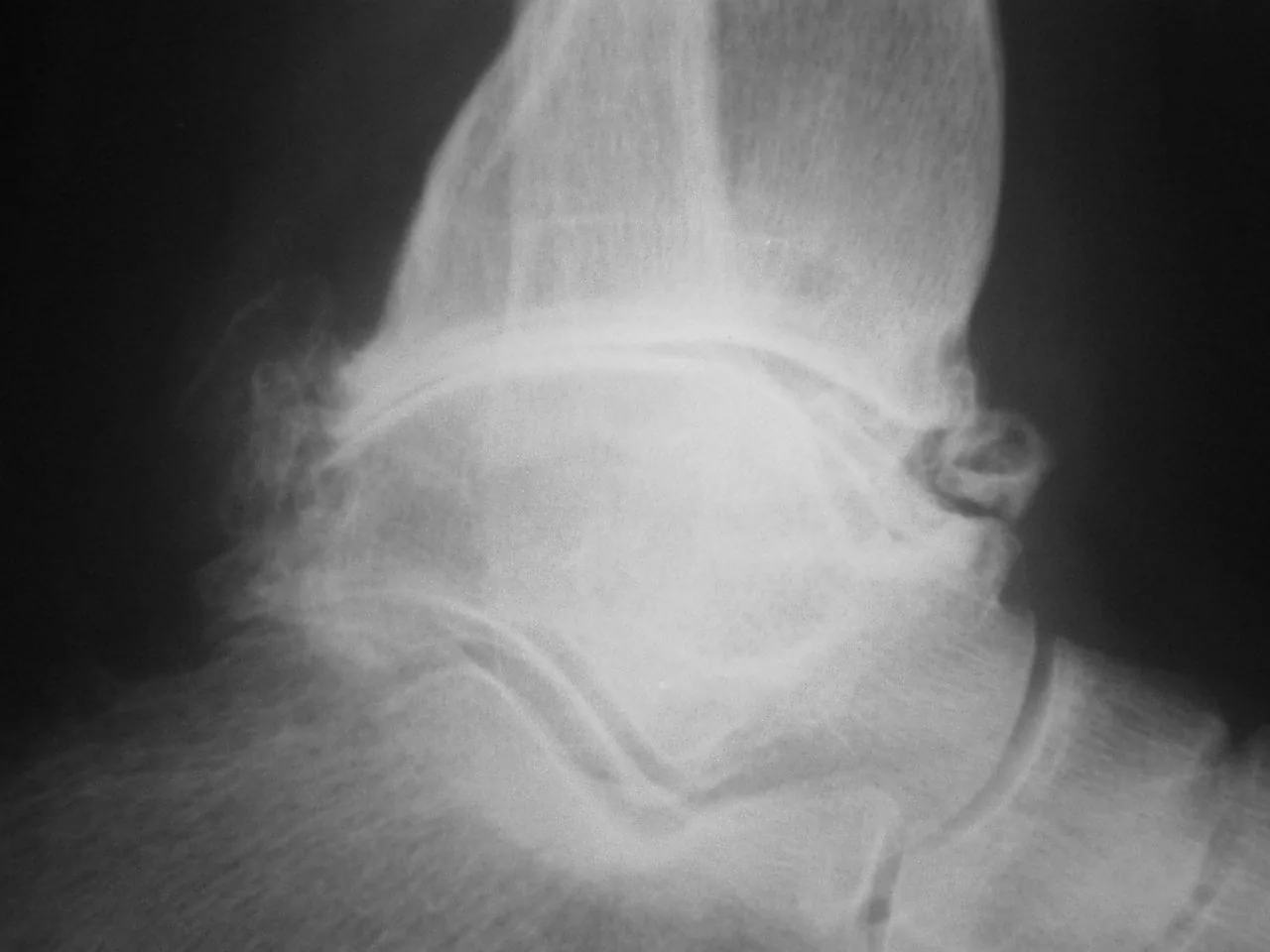 Bone & joint disease radiograph for self-assessment