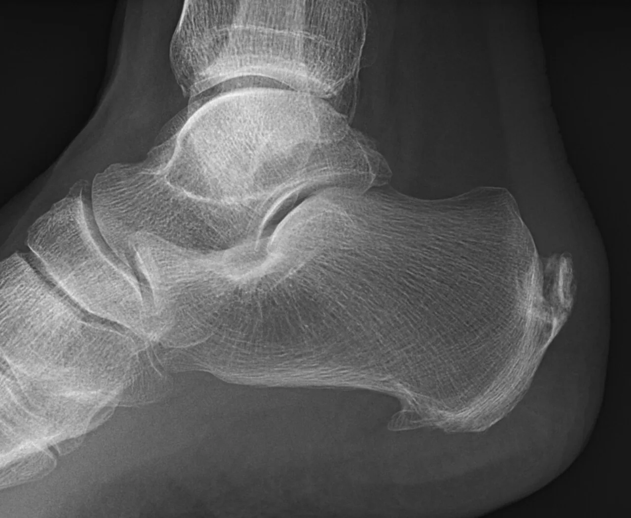 Lower limb radiograph for self-assessment