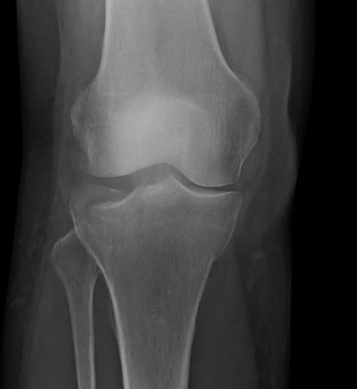 Lower limb radiograph for self-assessment