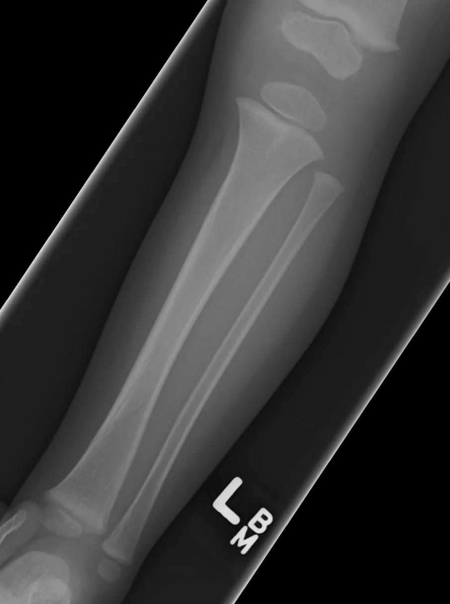 Lower limb radiograph for self-assessment