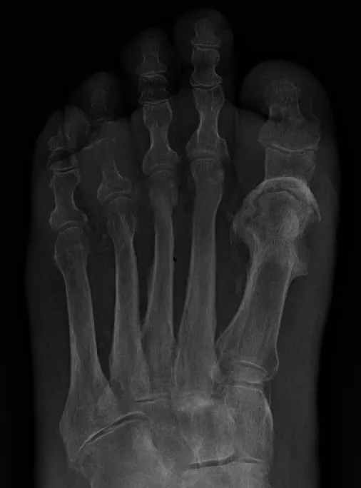 Bone & joint disease radiograph for self-assessment