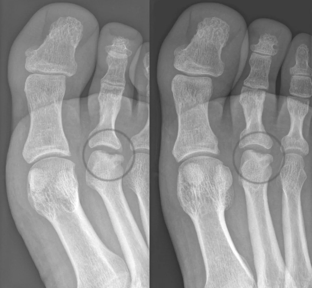 Bone & joint disease radiograph for self-assessment