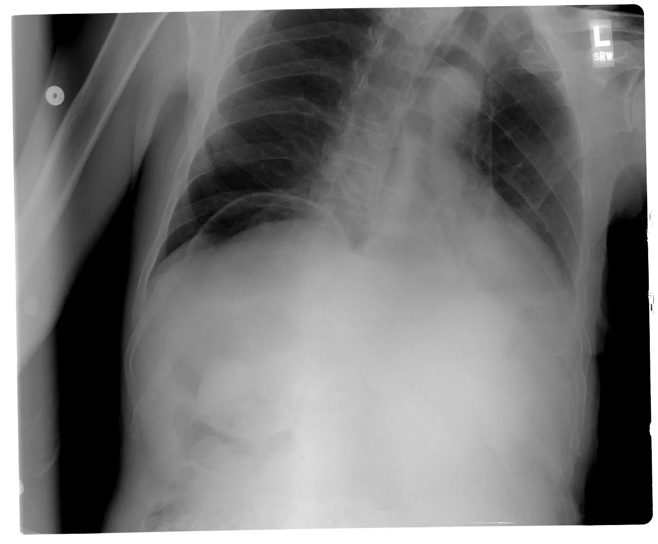 Abdomen radiograph for self-assessment