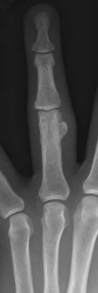 Bone & joint disease radiograph for self-assessment