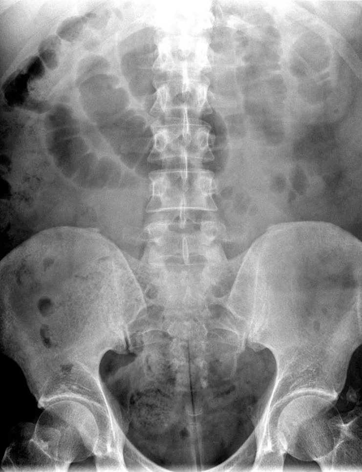 Abdomen radiograph for self-assessment