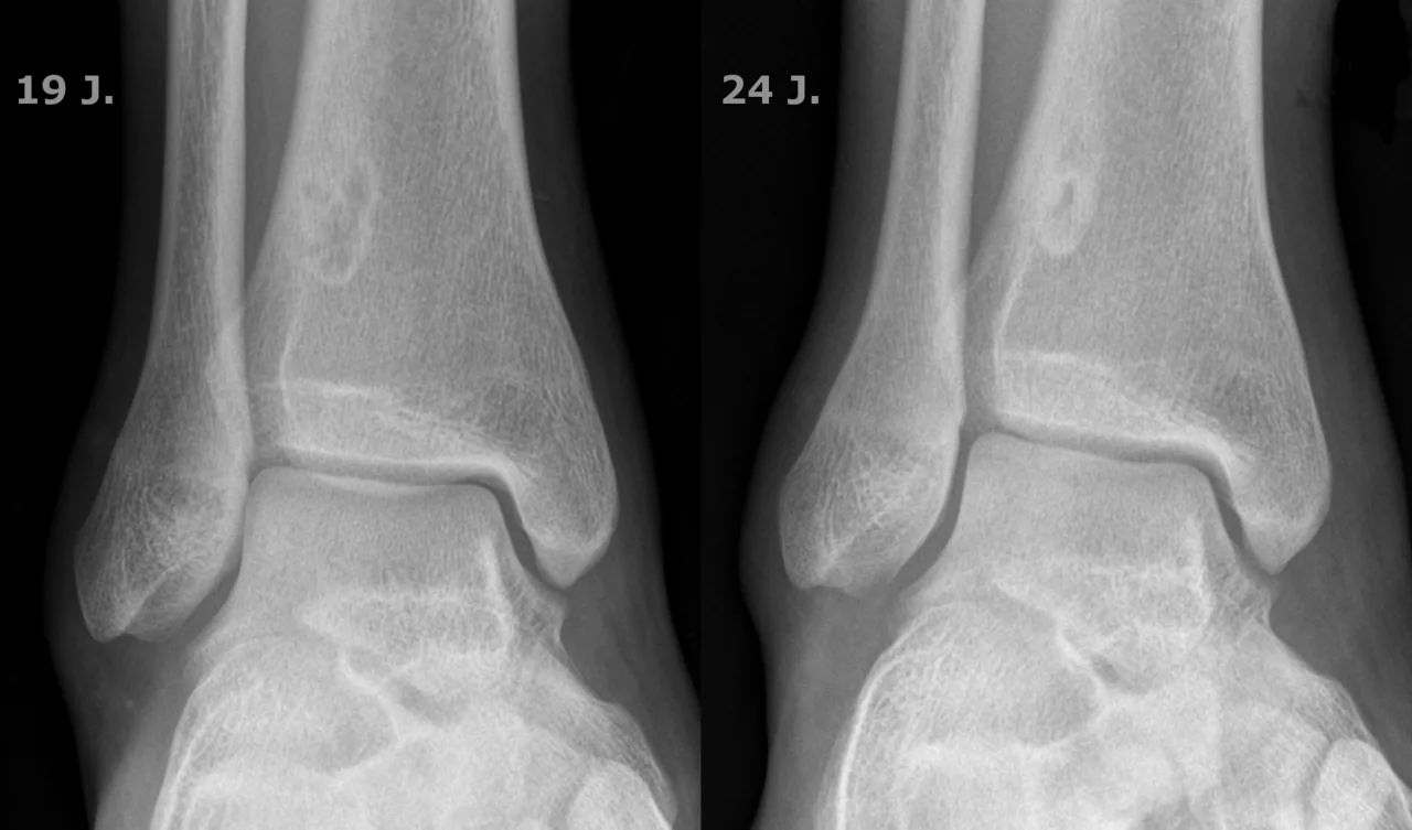 Bone & joint disease radiograph for self-assessment
