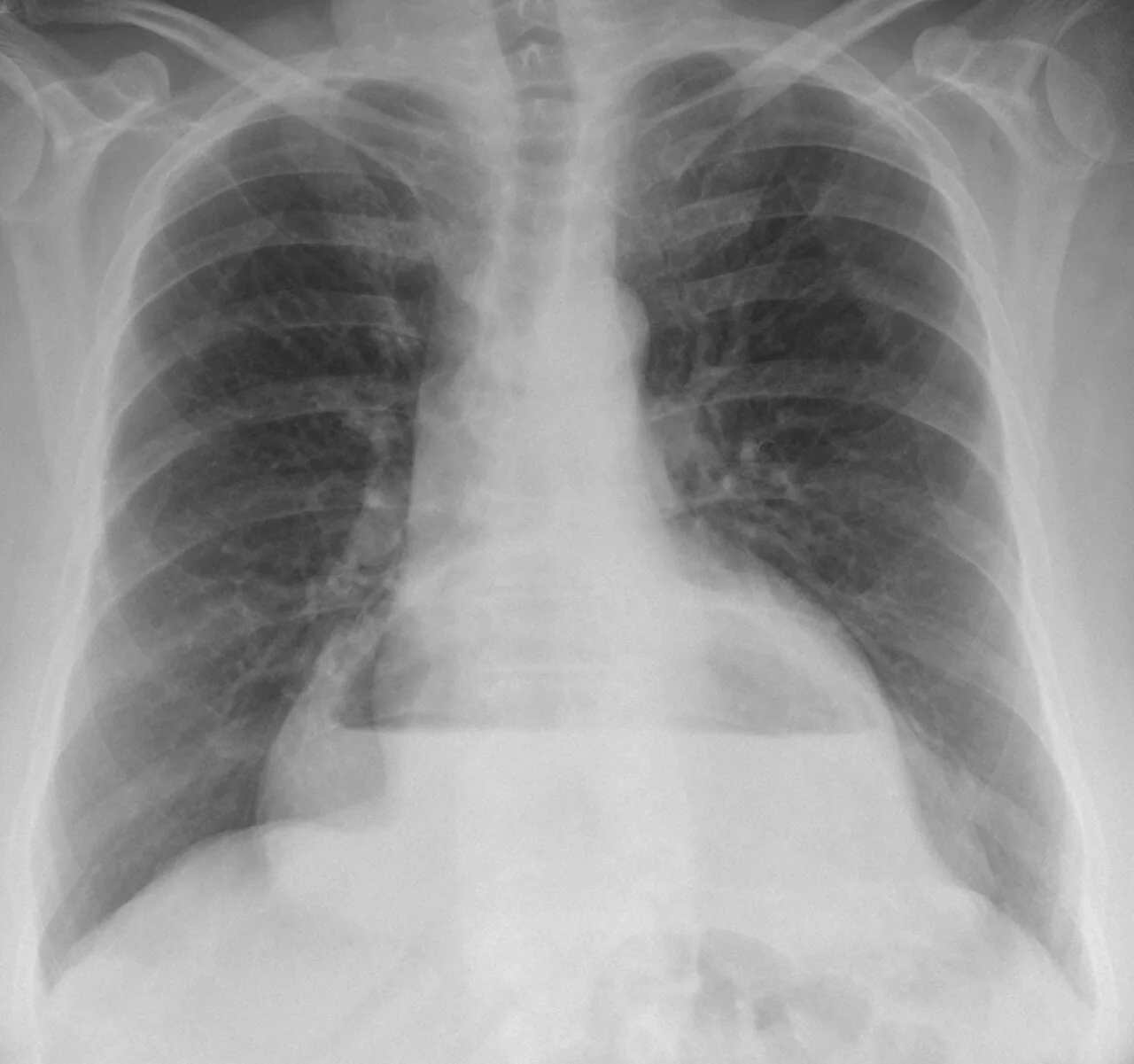 Chest radiograph for self-assessment
