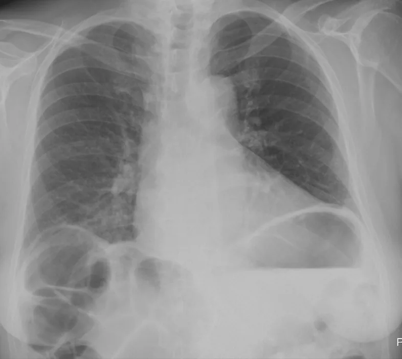 Abdomen radiograph for self-assessment