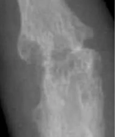 Bone & joint disease radiograph for self-assessment