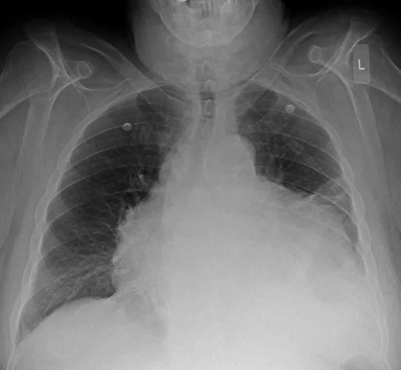 Chest radiograph for self-assessment