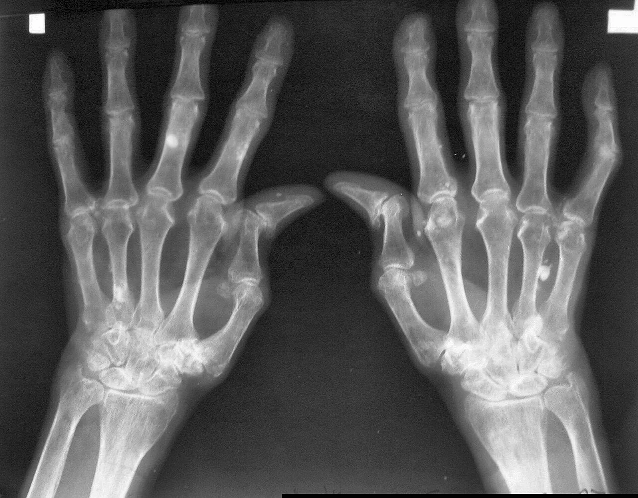 Bone & joint disease radiograph for self-assessment
