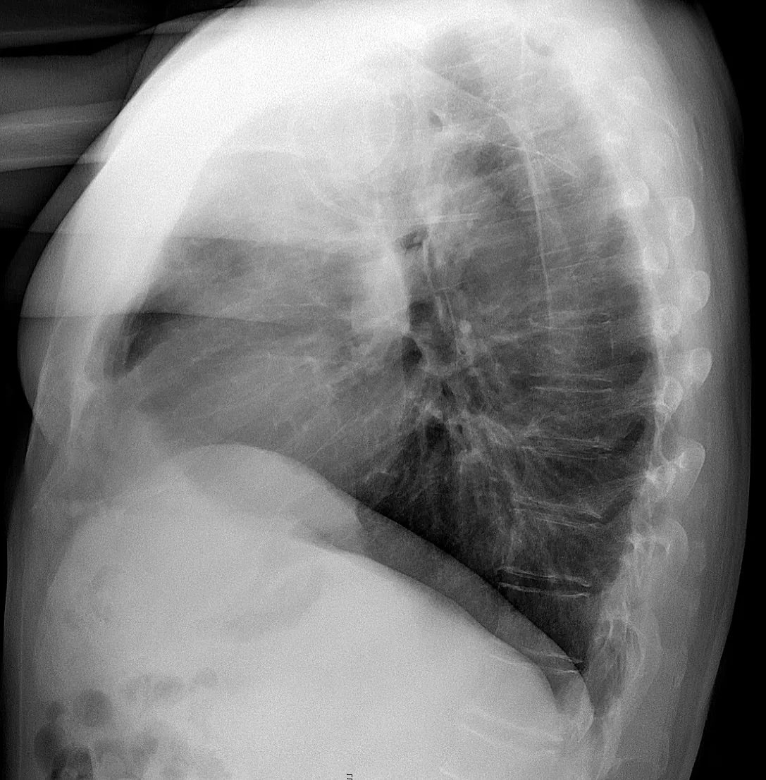 Lines & tubes radiograph for self-assessment