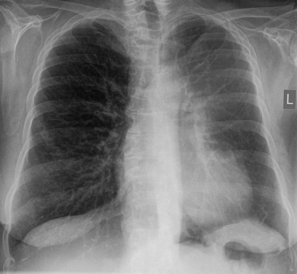 Chest radiograph for self-assessment