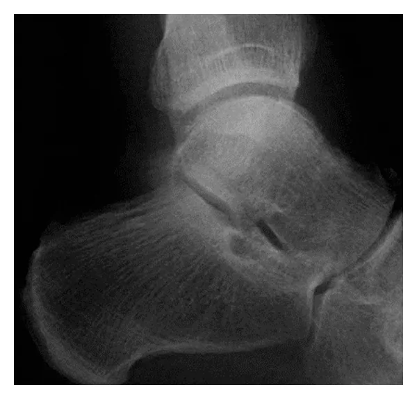 Lower limb radiograph for self-assessment