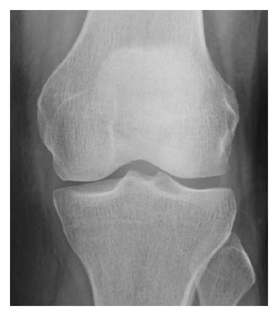 Lower limb radiograph for self-assessment