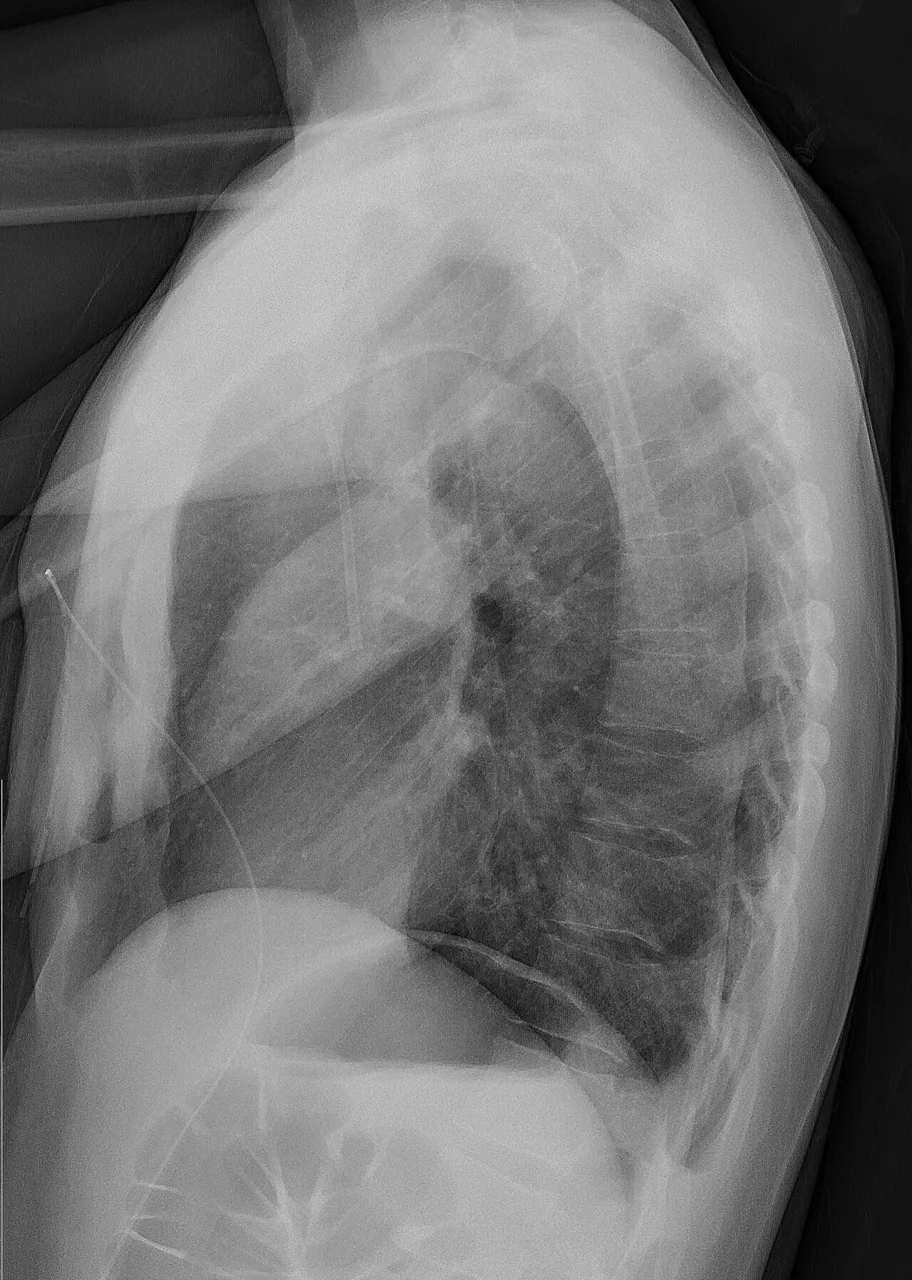 Chest radiograph for self-assessment
