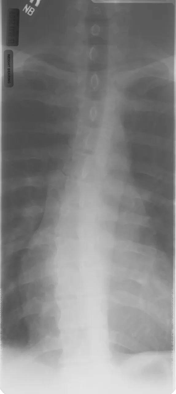Spine radiograph for self-assessment
