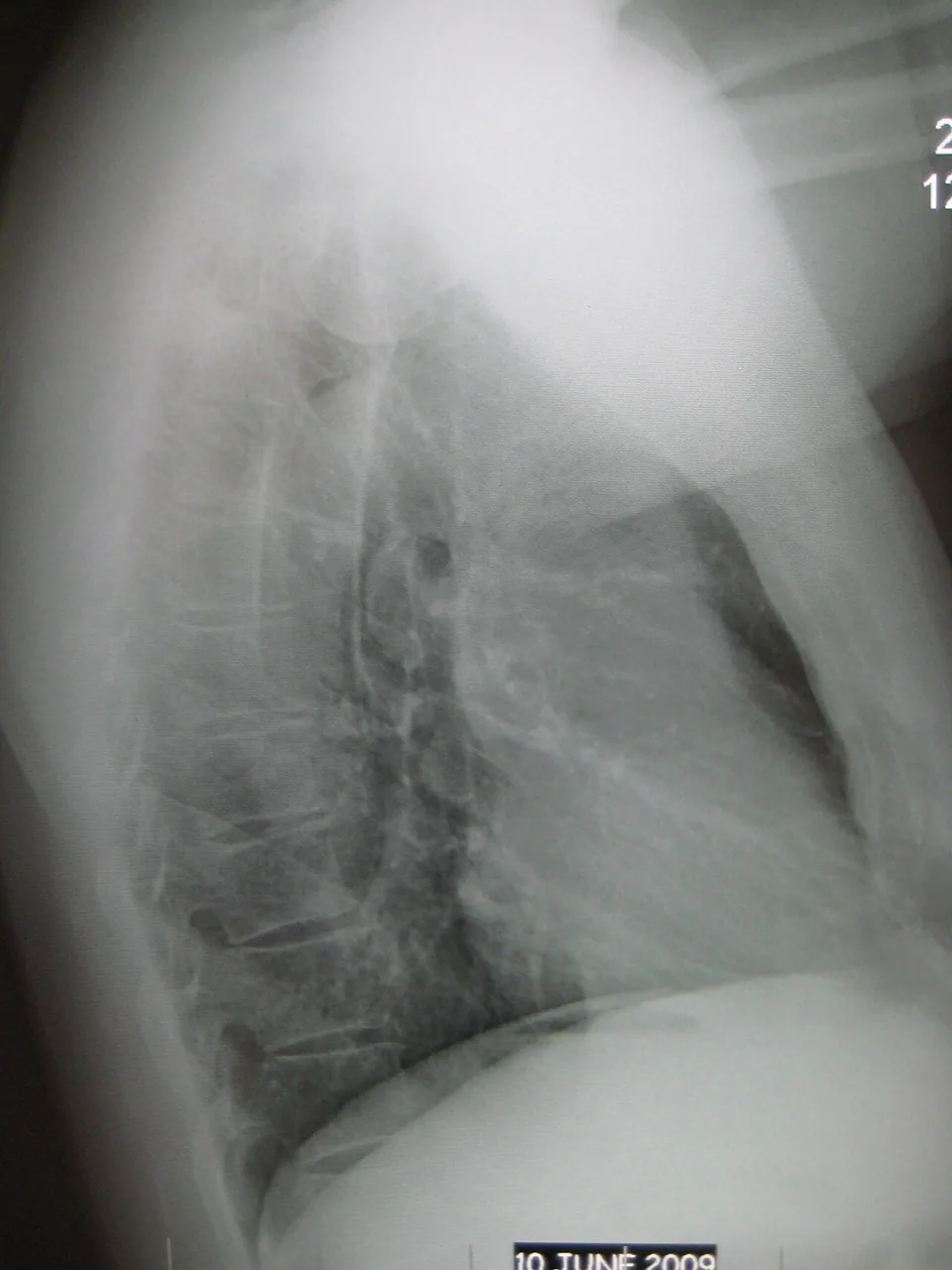 Chest radiograph for self-assessment